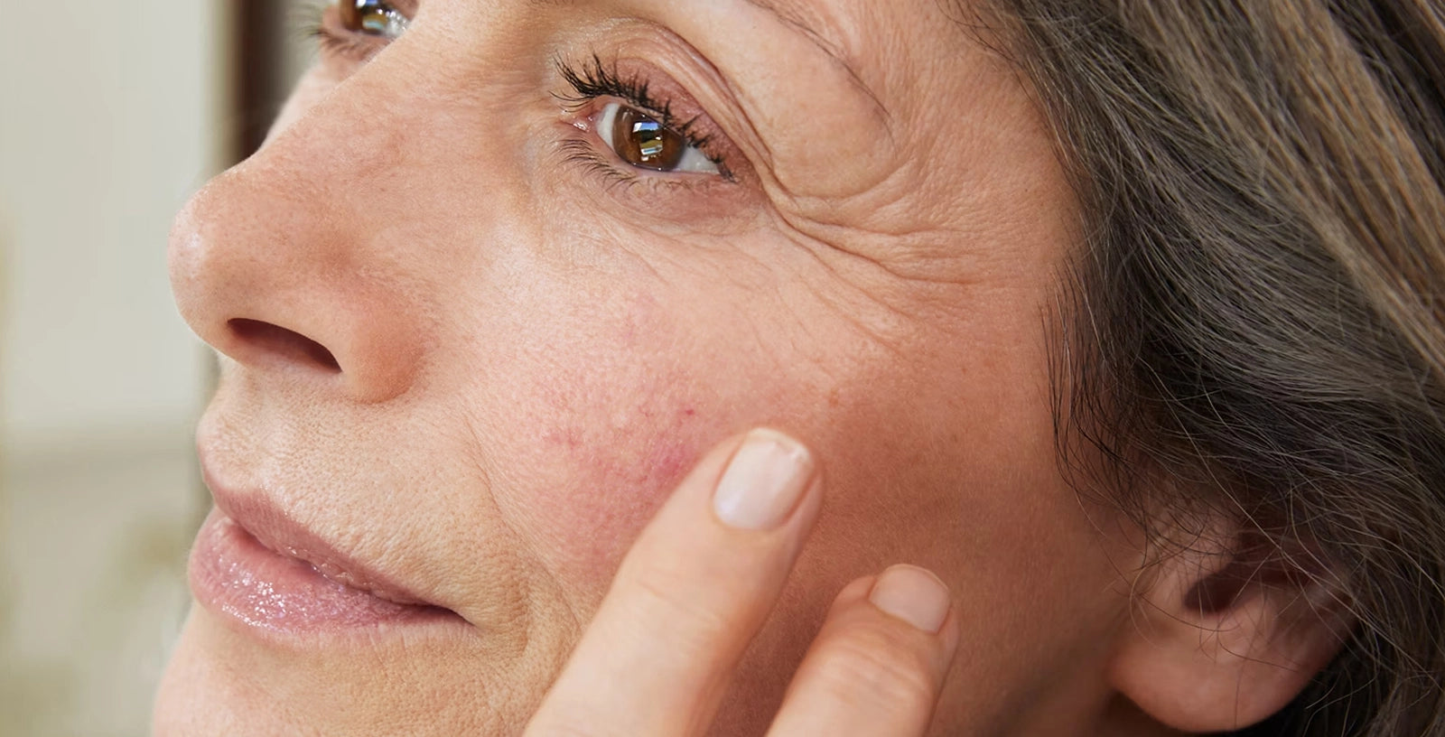 Mature sensitive skin