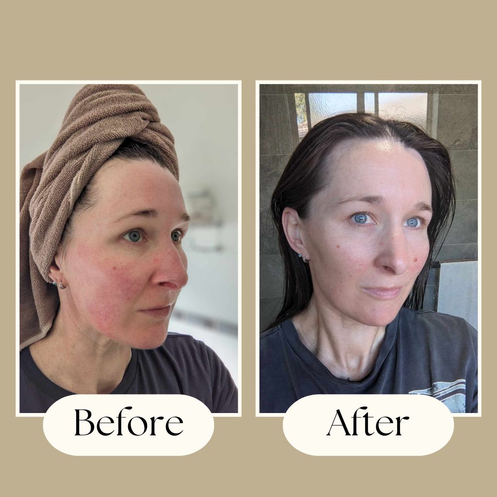 Morning & Night Face Oil Set | Anti-Ageing Duo