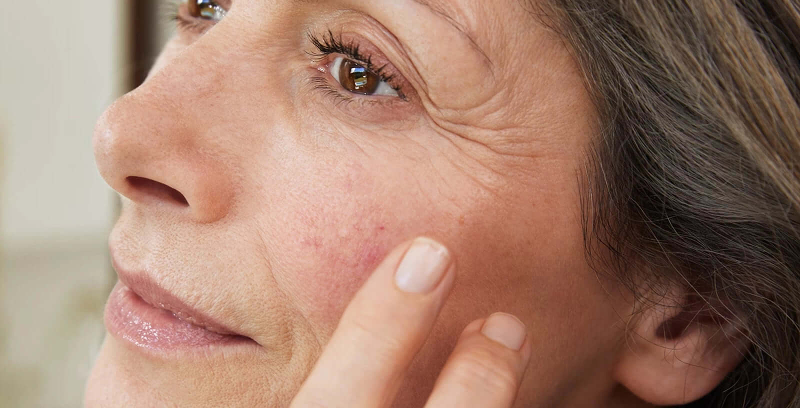 Mature sensitive skin